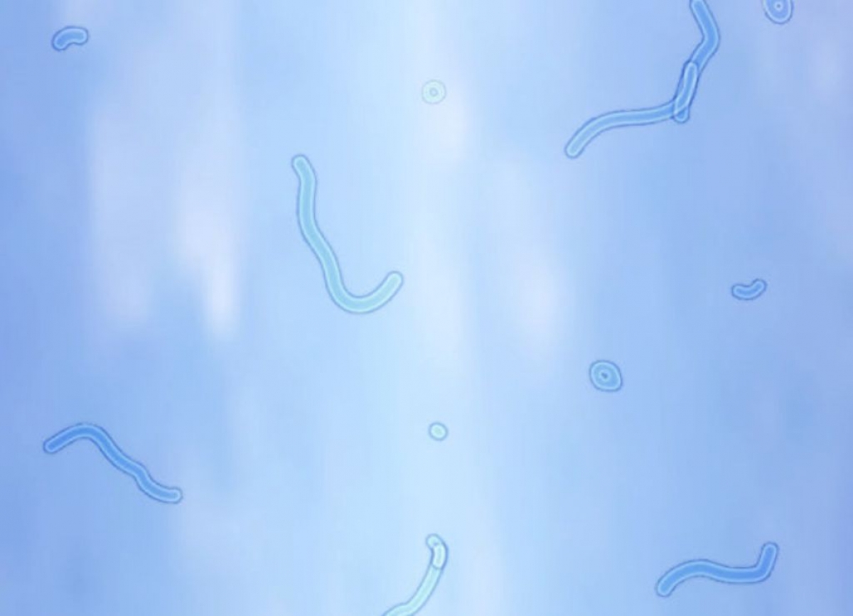 ¿Qué son las Moscas Volantes?